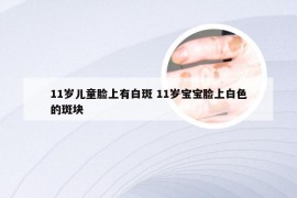 11岁儿童脸上有白斑 11岁宝宝脸上白色的斑块