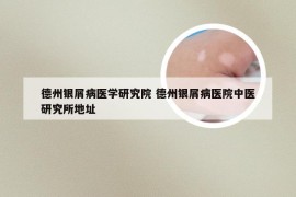 德州银屑病医学研究院 德州银屑病医院中医研究所地址