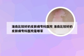 淮南比较好的皮肤病专科医院 淮南比较好的皮肤病专科医院是哪家
