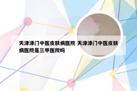 天津津门中医皮肤病医院 天津津门中医皮肤病医院是三甲医院吗