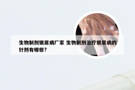 生物制剂银屑病厂家 生物制剂治疗银屑病的针剂有哪些?