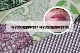 利辛皮肤医院哪家好 利辛皮肤医院哪家好些