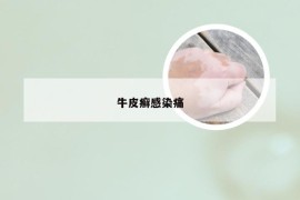 牛皮癣感染痛
