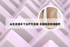 山东无棣乡下治疗牛皮癣 无棣路皮肤病医院
