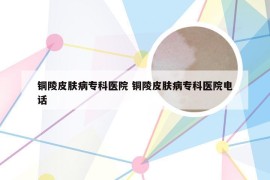 铜陵皮肤病专科医院 铜陵皮肤病专科医院电话