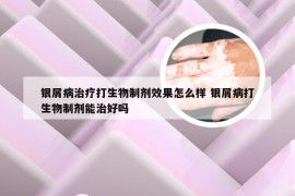 银屑病治疗打生物制剂效果怎么样 银屑病打生物制剂能治好吗