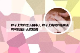 脖子上发白怎么回事儿 脖子上出现白色斑点有可能是什么皮肤病