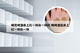喝完啤酒身上红一块白一块的 喝啤酒后身上红一块白一块