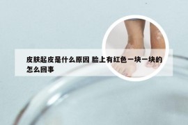 皮肤起皮是什么原因 脸上有红色一块一块的怎么回事