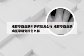 成都华西皮肤科研究院怎么样 成都华西皮肤病医学研究院怎么样