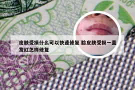 皮肤受损什么可以快速修复 脸皮肤受损一直发红怎样修复