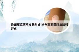 沧州那家医院皮肤科好 沧州那家医院皮肤科好点