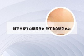 腋下出现了白斑是什么 腋下有白斑怎么办