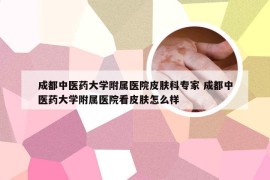 成都中医药大学附属医院皮肤科专家 成都中医药大学附属医院看皮肤怎么样