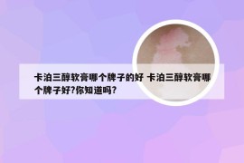 卡泊三醇软膏哪个牌子的好 卡泊三醇软膏哪个牌子好?你知道吗?