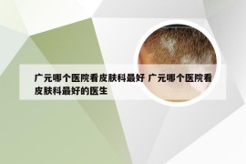 广元哪个医院看皮肤科最好 广元哪个医院看皮肤科最好的医生