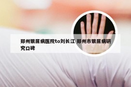 郑州银屑病医院to刘长江 郑州市银屑病研究口碑