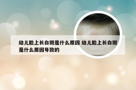 幼儿脸上长白斑是什么原因 幼儿脸上长白斑是什么原因导致的