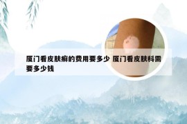 厦门看皮肤癣的费用要多少 厦门看皮肤科需要多少钱