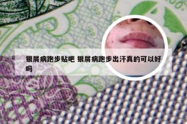 银屑病跑步贴吧 银屑病跑步出汗真的可以好吗