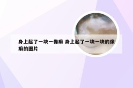 身上起了一块一像癣 身上起了一块一块的像癣的图片