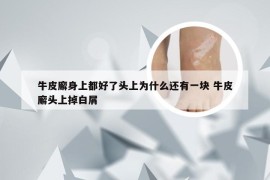 牛皮廨身上都好了头上为什么还有一块 牛皮廨头上掉白屑