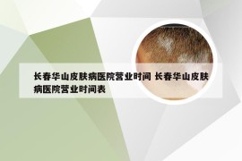 长春华山皮肤病医院营业时间 长春华山皮肤病医院营业时间表