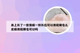 身上长了一些像癣一样长在可以用硫磺皂么 皮癣用硫磺皂可以吗