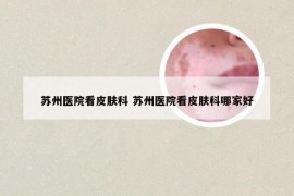 苏州医院看皮肤科 苏州医院看皮肤科哪家好