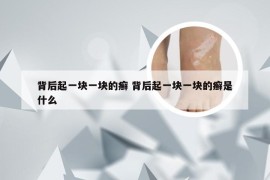 背后起一块一块的癣 背后起一块一块的癣是什么