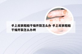 手上皮肤粗糙干燥开裂怎么办 手上皮肤粗糙干燥开裂怎么办啊