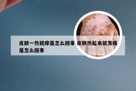 皮肤一热就痒是怎么回事 皮肤热起来就发痒是怎么回事