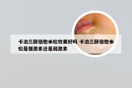 卡泊三醇倍他米松效果好吗 卡泊三醇倍他米松是强激素还是弱激素