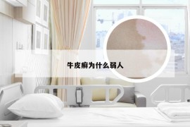 牛皮癣为什么弱人