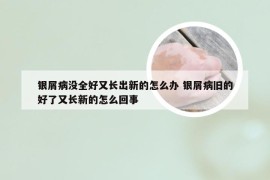 银屑病没全好又长出新的怎么办 银屑病旧的好了又长新的怎么回事