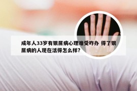 成年人33岁有银屑病心理难受咋办 得了银屑病的人现在活得怎么样?