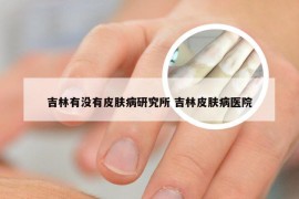 吉林有没有皮肤病研究所 吉林皮肤病医院