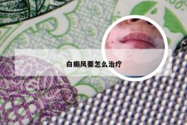 白癜风要怎么治疗