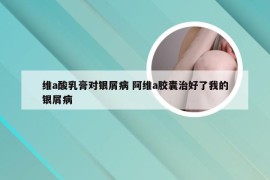 维a酸乳膏对银屑病 阿维a胶囊治好了我的银屑病