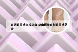 辽源银屑病查找华山 华山医院自制银屑病药膏