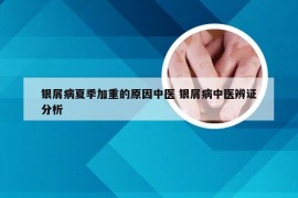 银屑病夏季加重的原因中医 银屑病中医辨证分析