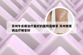 苏州牛皮癣治疗最好的医院是哪家 苏州银屑病治疗哪家好