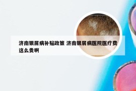 济南银屑病补贴政策 济南银屑病医院医疗费这么贵啊