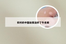 农村的中医给我治好了牛皮癣