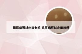 银屑病可以吃田七吗 银屑病可以吃田鸡吗