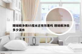 珊瑚癣净用85度水还有效果吗 珊瑚癣净放多少温水