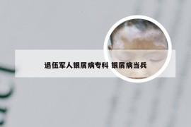退伍军人银屑病专科 银屑病当兵