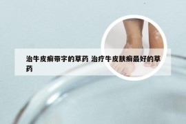 治牛皮癣带字的草药 治疗牛皮肤癣最好的草药