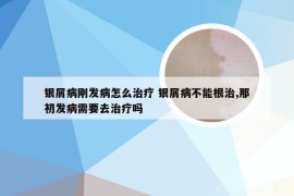 银屑病刚发病怎么治疗 银屑病不能根治,那初发病需要去治疗吗