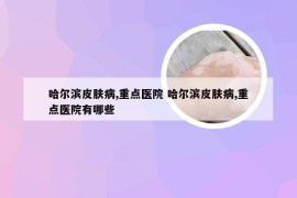 哈尔滨皮肤病,重点医院 哈尔滨皮肤病,重点医院有哪些